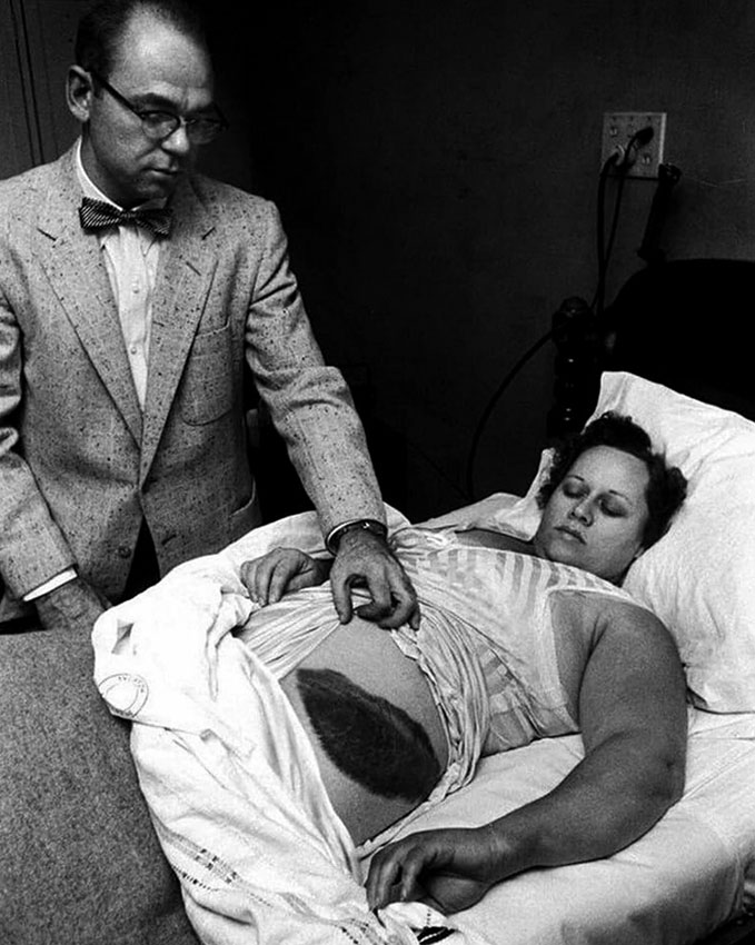 Потерпевшая, которую поразил метеорит, 1954 год Доктор Муди... Потерпевшая, которую поразил метеорит, 1954 год Доктор Муди...